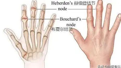 绘画缺少逼真手部参考？HandModel的缩放旋转功能让你轻松掌控细节！